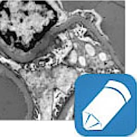 Electron Microscopy