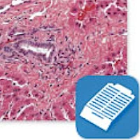 Paraffin Tissue Processing