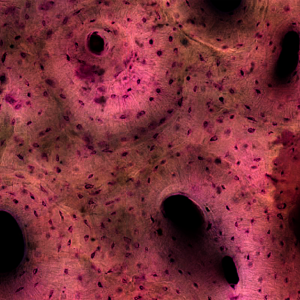 Acid Fuchsin