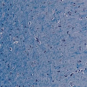 Luxol Fast Blue MBS