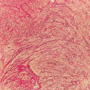 Van Gieson's Stain